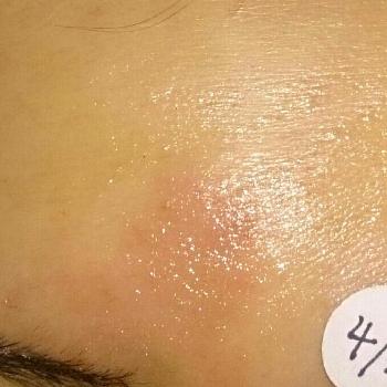 肌アレルギーの投稿画像一覧 Greensnap グリーンスナップ