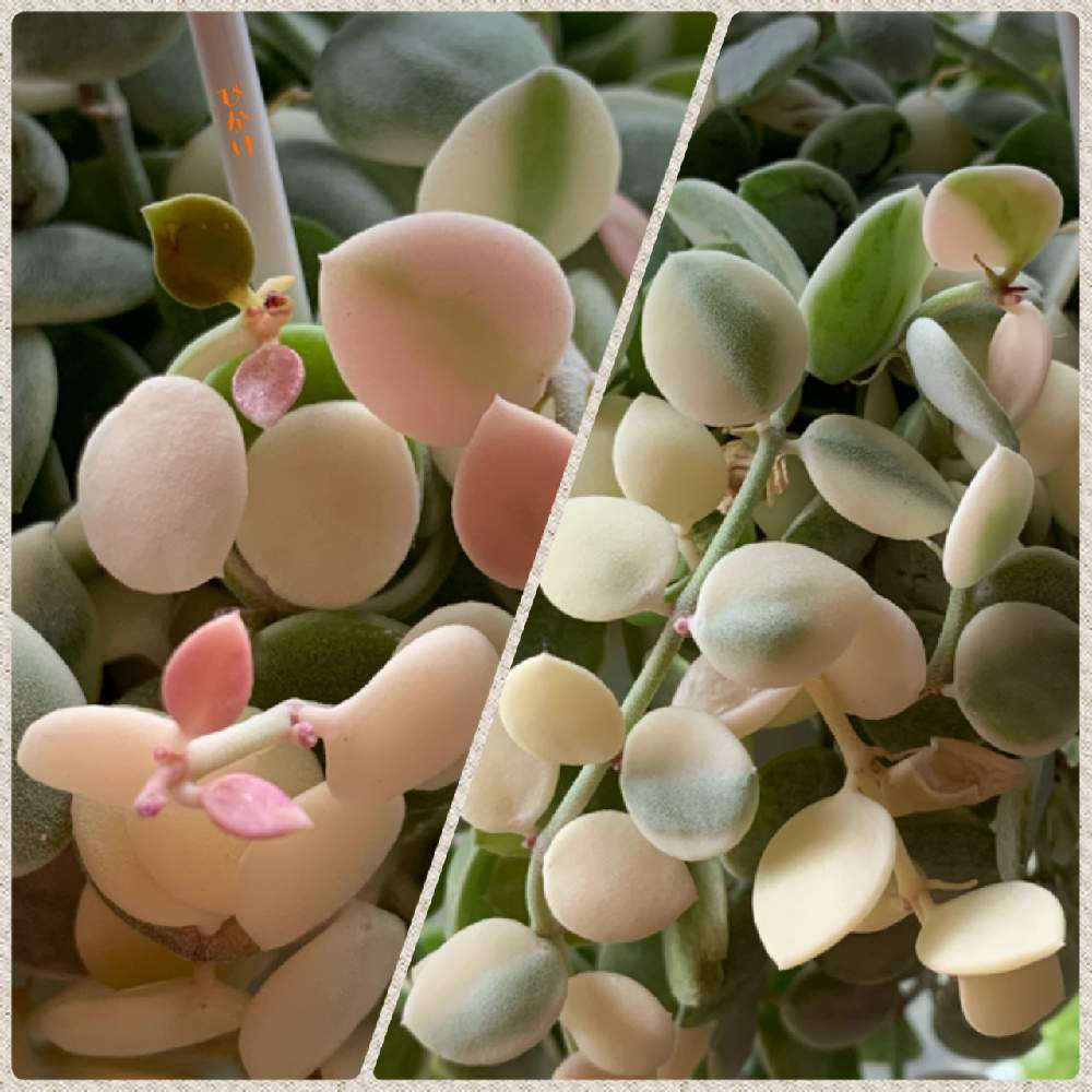 Remedios Caseros Para Expulsar Las Piedras En El Rin